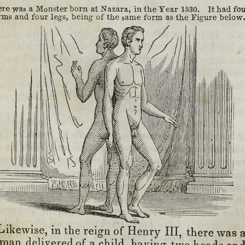 Engraving from The midwife's guide, 1845, copyright The Library Company of Philadelphia